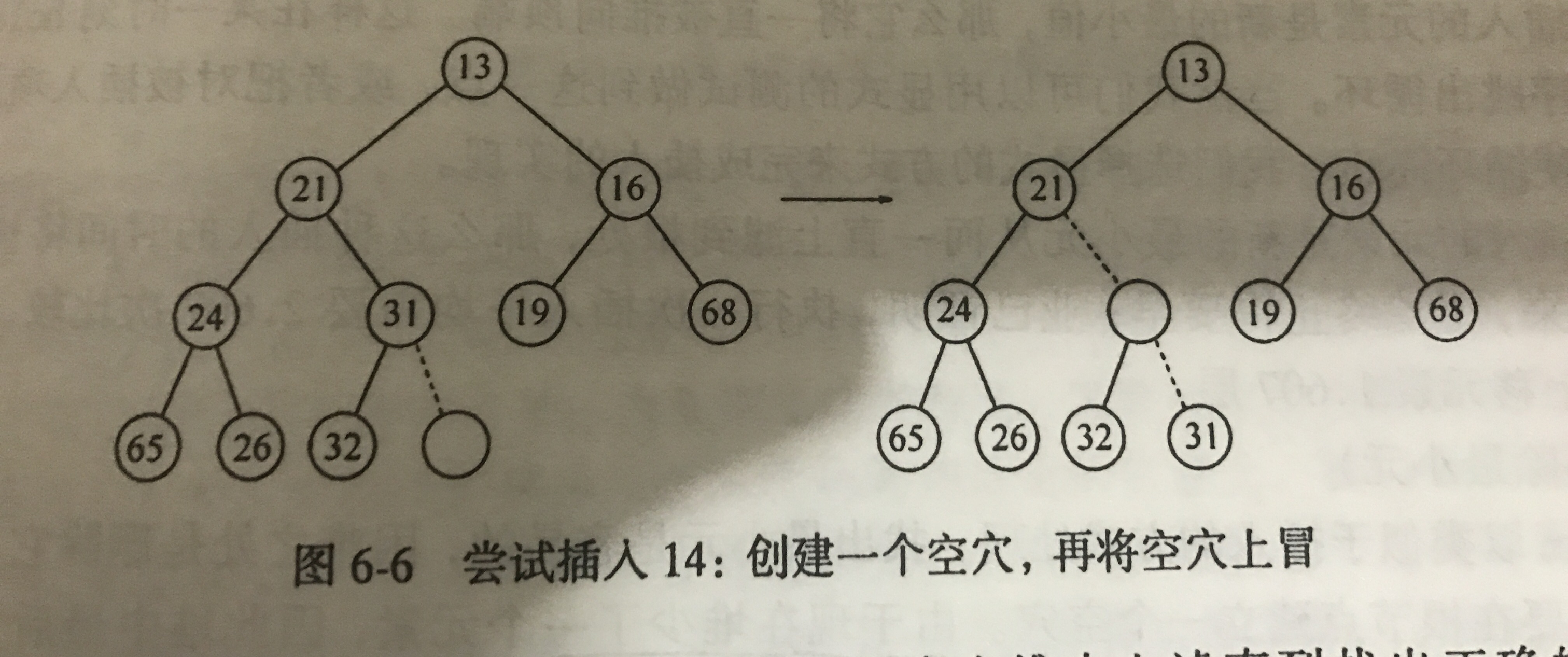 上虑插入示意图1