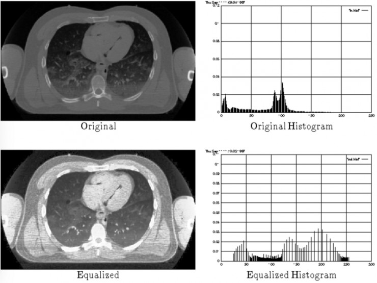 用Keras和“直方图均衡”为深度学习实现“图像扩充”