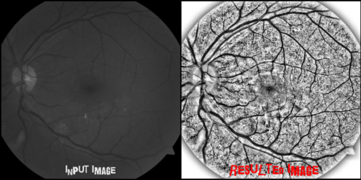 用Keras和“直方图均衡”为深度学习实现“图像扩充”