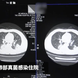 瓜派优秀员工于2018-12-14 12:08发布的图片