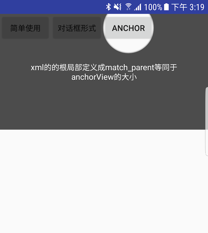 anchor