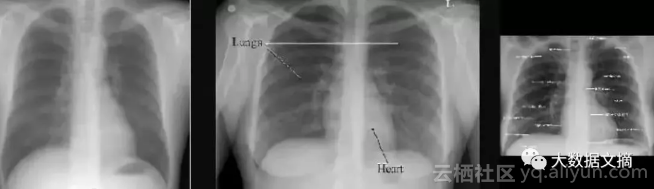 9052e76d4e92c26316147486062e4e59078fcde4