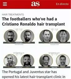 阿里扎心年终奖：价值“三万八”的植发钱公司掏，这波不亏