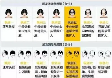 阿里扎心年终奖：价值“三万八”的植发钱公司掏，这波不亏