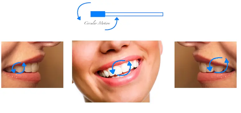 圆弧刷牙法示意图三：如果你时间比较着急，可以用画圆圈的方式轻柔缓慢地刷每个区的牙齿