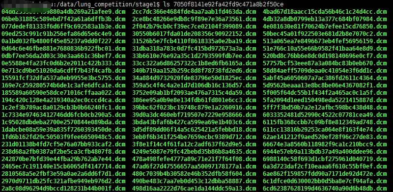 dicom格式的图像