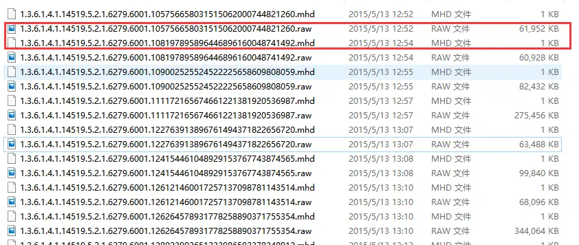 dicom格式的图像