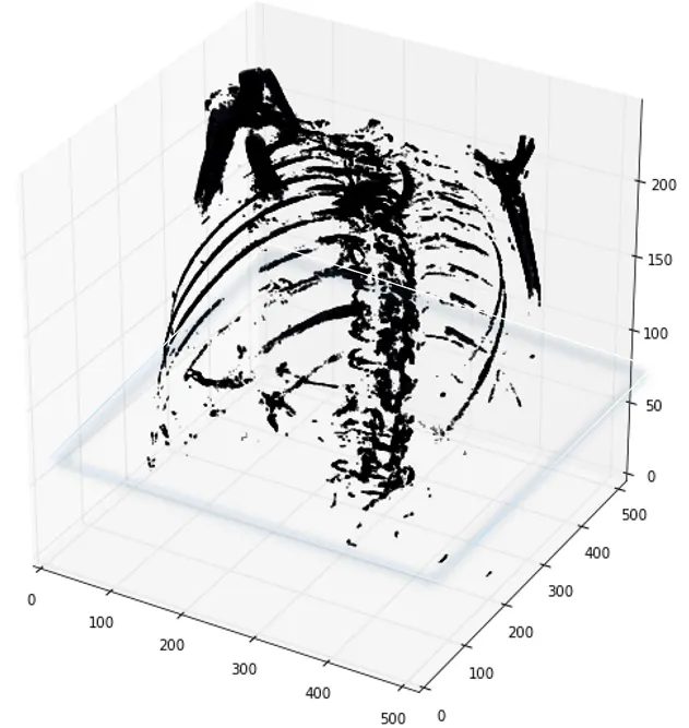 dicom格式的图像