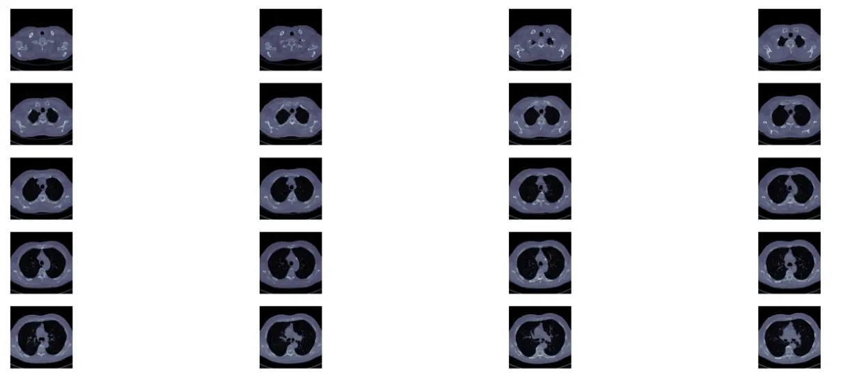 dicom格式的图像