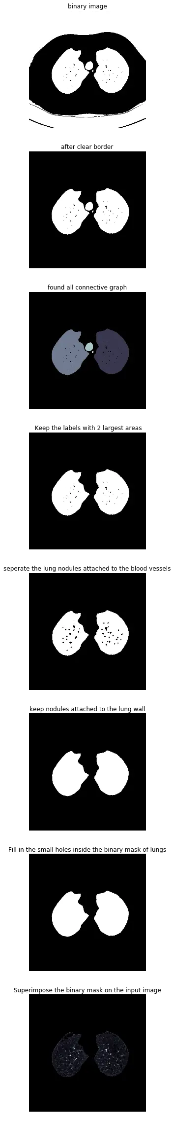 dicom格式的图像